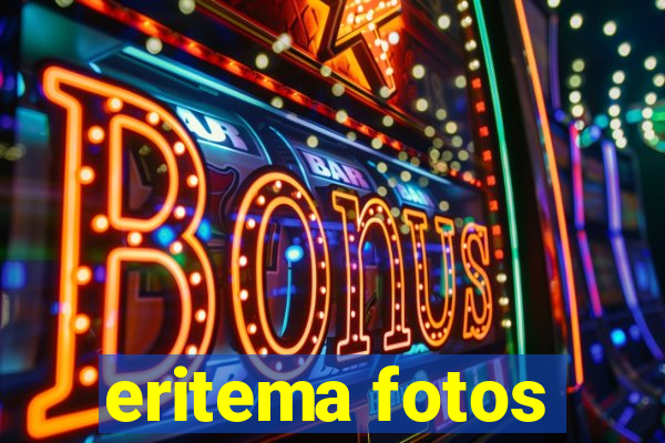 eritema fotos